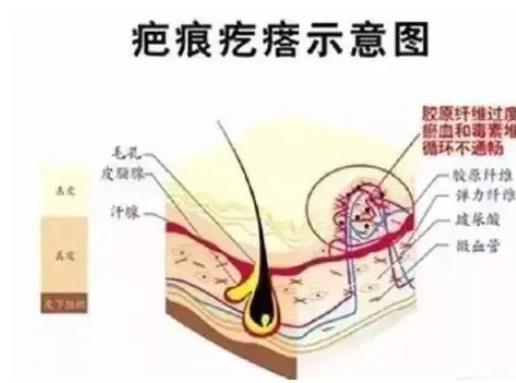 西京整形科怎么样?权威医生：宋保强资料-擅长get~2022价格表分享