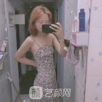 北京加减美整形医院怎么样？减肥成果有吗？附腰部吸脂实例