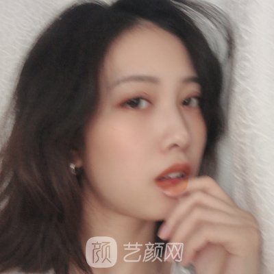 南京华美王小林口碑怎么样？2022招牌双眼皮实例曝光