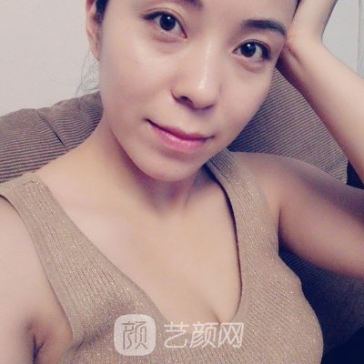 西安叶子朱健康医生隆胸实例出炉｜附前后对比成果图