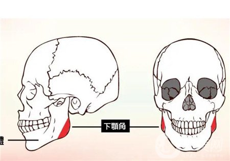 磨骨手术对比照片 磨骨*果怎么样？