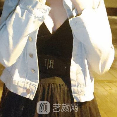 北京新星靓隆胸价格更新？内附真人体验实例