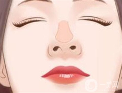 耳软骨垫鼻尖的原理是什么？什么样的假体垫鼻尖会穿透鼻尖？