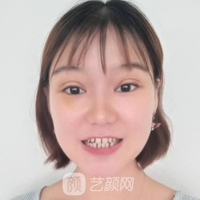 天津美莱口腔医院牙齿正畸怎么样？矫正前后成果图曝光