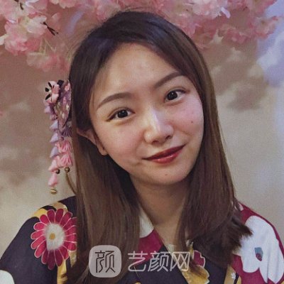 重庆莱森医疗美容门诊部怎么样？2022全新植发实例分享