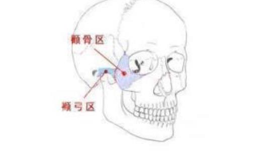 详细解答：湘雅二医院整形美容科