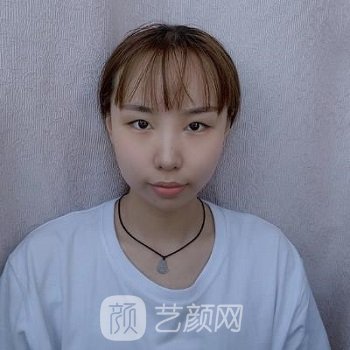 北京王瑛医美技术怎么样？概况介绍+双眼皮整形实例