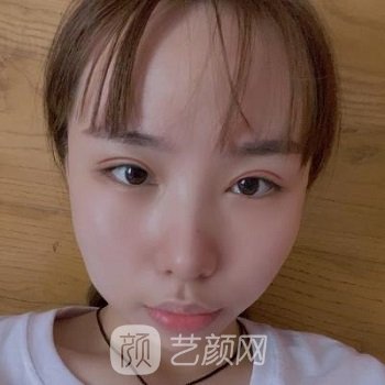 北京王瑛医美技术怎么样？概况介绍+双眼皮整形实例