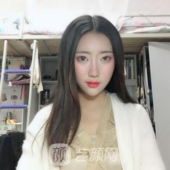 陈倩医生鼻综合实例更新，做个鼻子有一种女神风