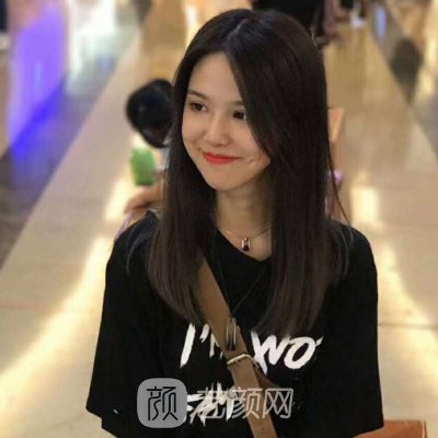 深圳美亚割双眼皮靠谱吗？2022招牌实例展示