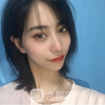 郭英宁做的眼睛怎么样？多少钱？个人介绍+双眼皮手术实例