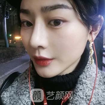 罗飞彪做鼻子怎么样？医生实力点评+假体隆鼻实例更新