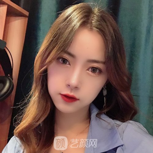 深圳医美汇医疗美容双眼皮正规吗？全新实例出炉