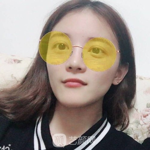 深圳爱氏医疗美容门诊部怎么样？光子嫩肤实例全新一览