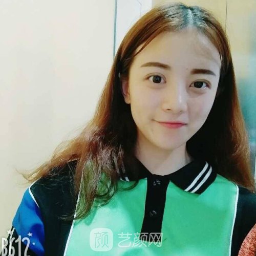 深圳爱氏医疗美容门诊部怎么样？光子嫩肤实例全新一览