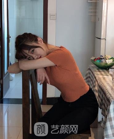 广州南珠整形吸脂疼不疼？概况介绍+技术点评，附吸脂实例