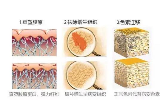郑大二附院整形科去疤痕果咋样？实例果_2021价格表全览！