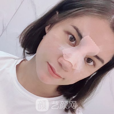 成都大华韩艺整形医院隆鼻怎么样？医院实力及实例出炉