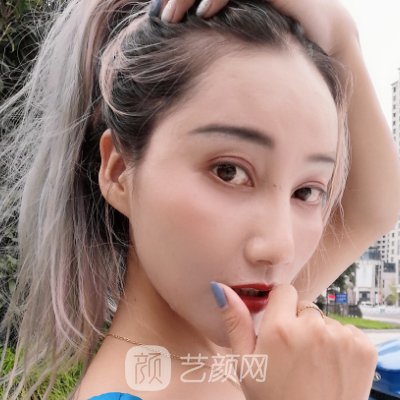 长春悦美汇整形医院做拉皮咋样？亲身体验实例出炉