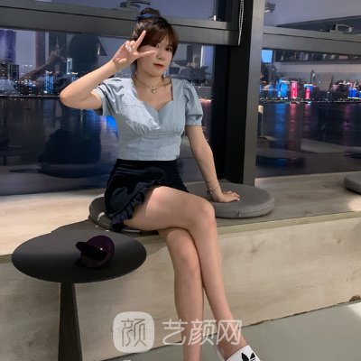 杭州艺然美医疗美容正规吗？医院招牌吸脂实例展示