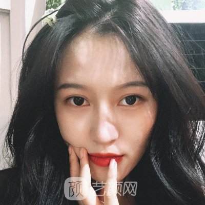 杭州菁漾医美是正规的吗？2022双眼皮实例公开