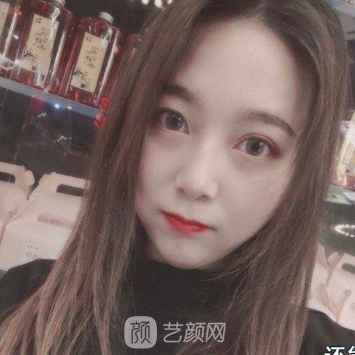 杭州艾菲医疗美容门诊部怎么样？医院招牌隆鼻实例出炉