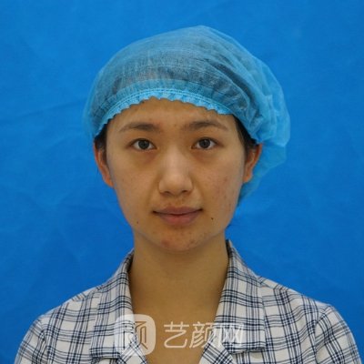 杭州婉美医疗美容诊所皮肤美容实例出炉|前后对比让人惊讶