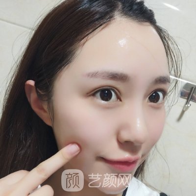 杭州美立方医院割双眼皮怎么样？医院全新体验实例分享