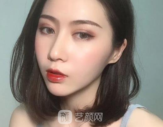 大同美神整形医院割双眼皮好不好？2022招牌实例展示