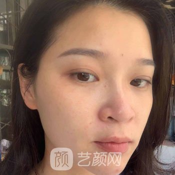 湖州中心医院吴原好吗？个人简介激光美肤实例