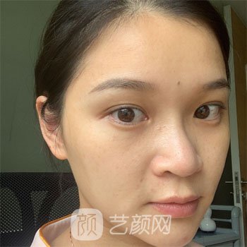 湖州中心医院吴原好吗？个人简介激光美肤实例