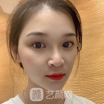 湖州中心医院吴原好吗？个人简介激光美肤实例