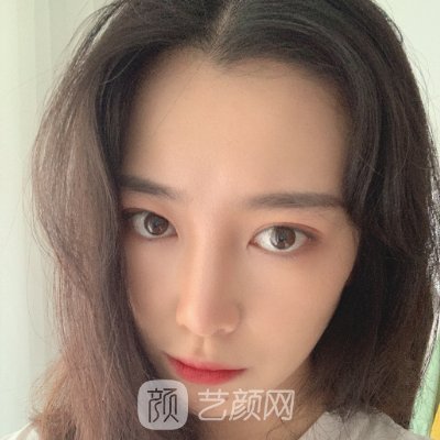 乌鲁木齐伊丽莎白整形医院正规吗？双眼皮实例及成果图出炉