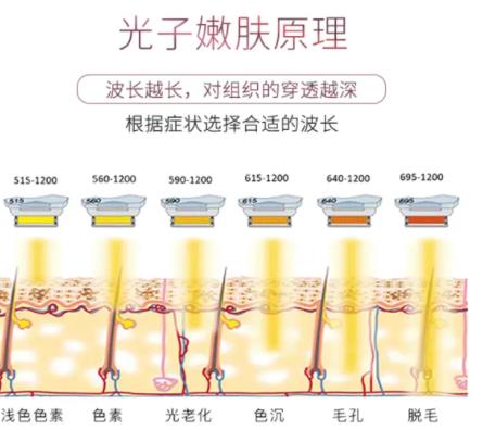 光子嫩肤热解的原理是什么?