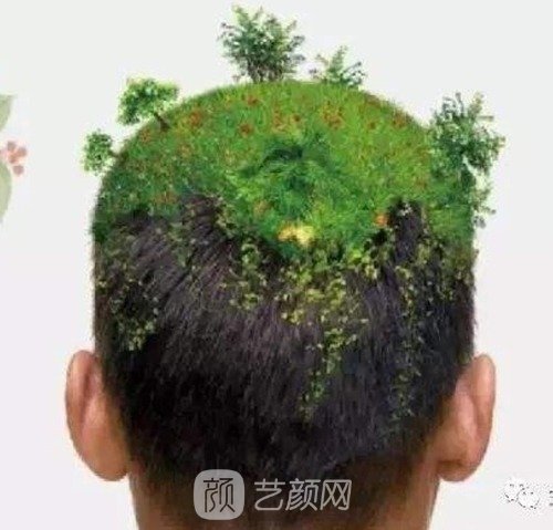 揭阳植发哪家好一点？十大正规植发医院放心选！