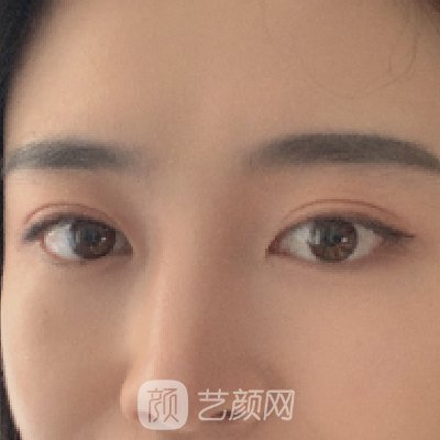 上海馥兰朵陈超群做眼睛怎么样？医生招牌实例一览