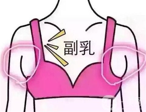 副乳切除后如何可以帮助修复呢？