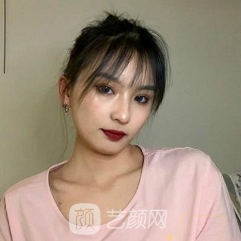 北京八大处李强医生简介双眼皮整形实例，附价格表