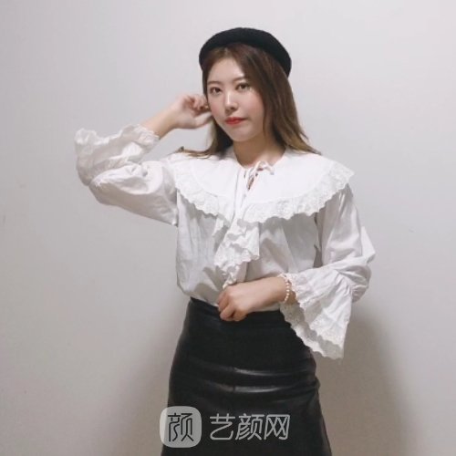苏州美莱整形医院腰腹环吸实例公开｜内附体验前后对比图