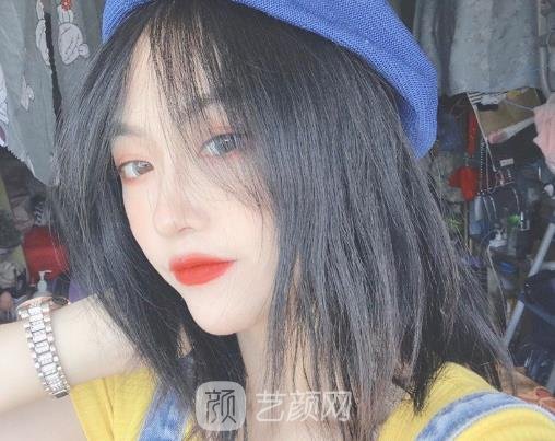 杭州格莱美口腔医院种牙好不好？2022招牌实例公布