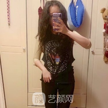 宁波市第六医院私密整形成果靠谱吗？2022阴唇整形实例分享