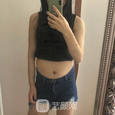 昆医大二附院吸脂手术多少钱？官网收费标准及实例出炉