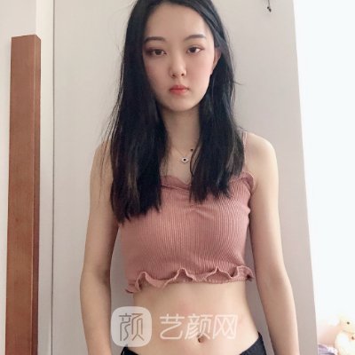 昆医大二附院吸脂手术多少钱？官网收费标准及实例出炉