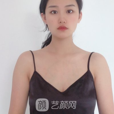 莆田市第一医院整形科隆胸多少钱？官方价格表及实例展示