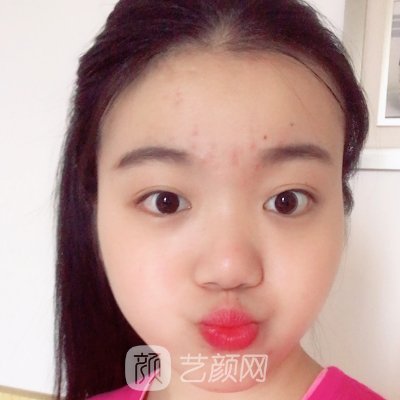 杭州美莱做鼻子怎么样?医院实力及实例出炉