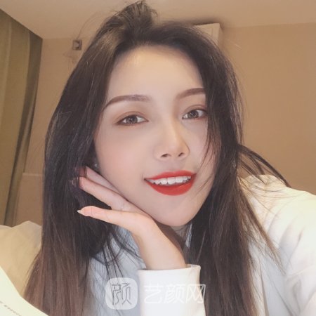 沈阳杏林王贵雄做眼袋怎么样?医生招牌实例公布