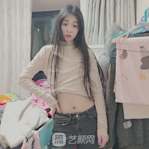无锡瑞丽整形医院私密紧缩实例出炉|成果自然美观