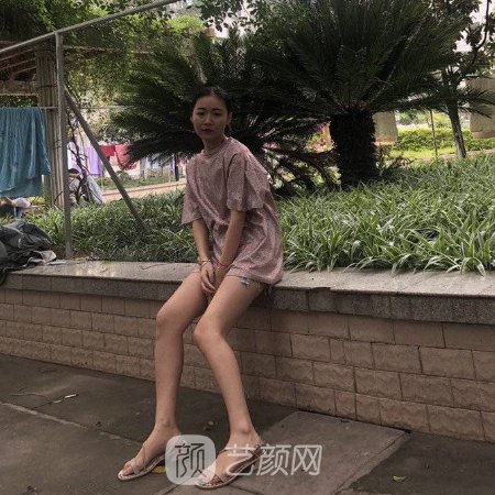 上海美莱全身抽脂大概要多少钱?官网价格表及实例分享