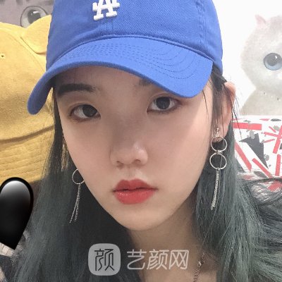 上海薇琳磨骨怎么样?医院实力及实例分享