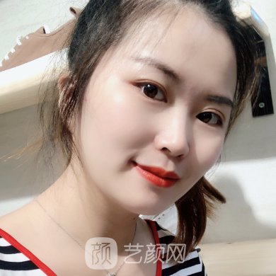 广州肤康医院是正规的吗?医院全新嫩肤除皱实例一览